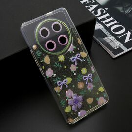 Futrola WHISPER - Huawei Honor X9C/Magic 7 lite zuta (MS).